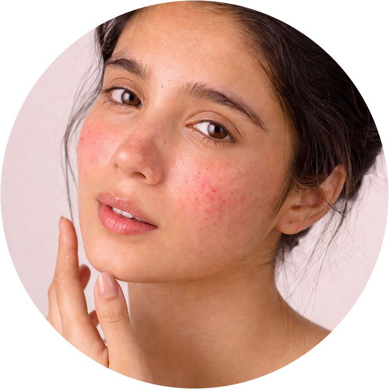 Sensitive Skin - Glamline