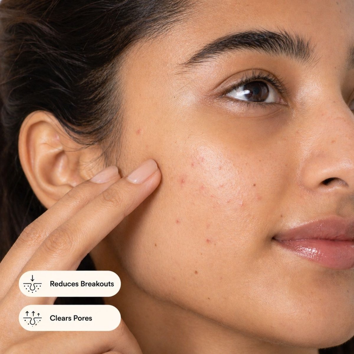 Anti Acne Serum Boosted with Salicylic Acid - Glamline